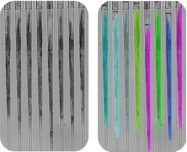 Automated worm body detection and analysis output
